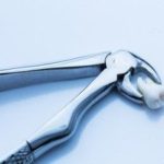 抜く？抜かない？親知らず！